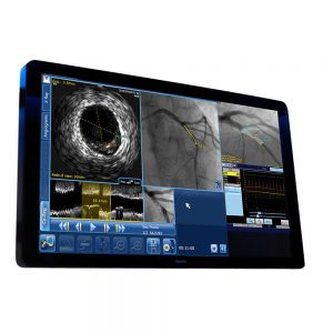 Syncvision — система для выполнения высокоточной терапии