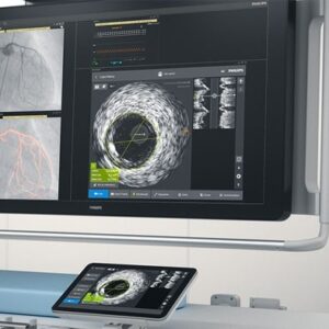 Philips Intrasight — платформа для интервенионных вмешательств