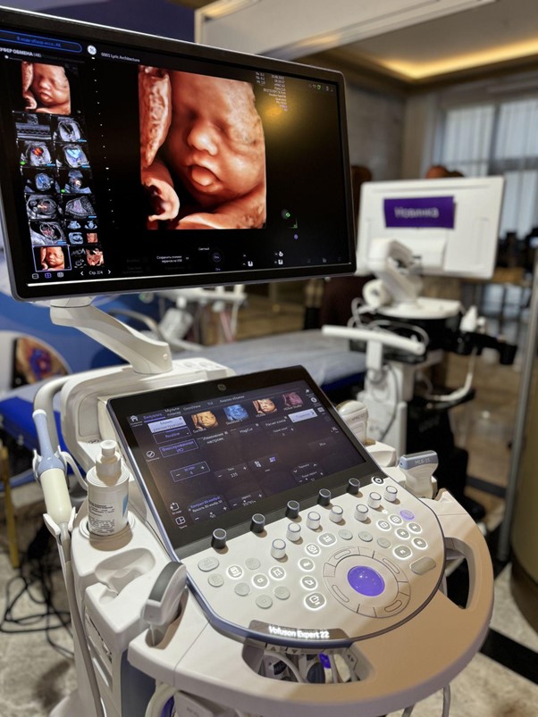 УЗИ-аппарат