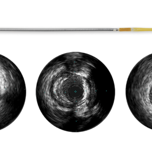 Refinity — катетер ВСУЗИ