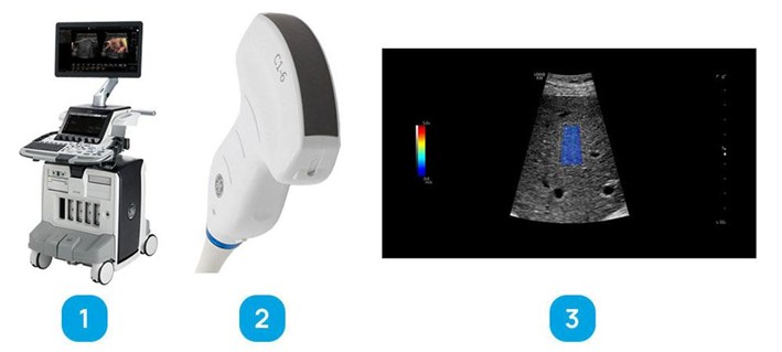 УЗИ-аппарат GE LOGIQ E10