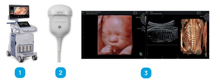 Аппарат General Electric Voluson E10, датчик и примеры получаемых изображений