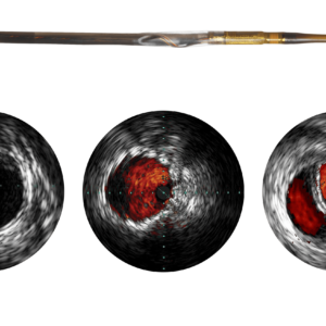 Visions PV (0,018 ДЮЙМА) — катетер ВСУЗИ