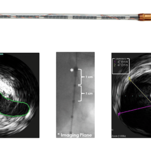 Visions PV (0,035 ДЮЙМА) — катетер ВСУЗИ