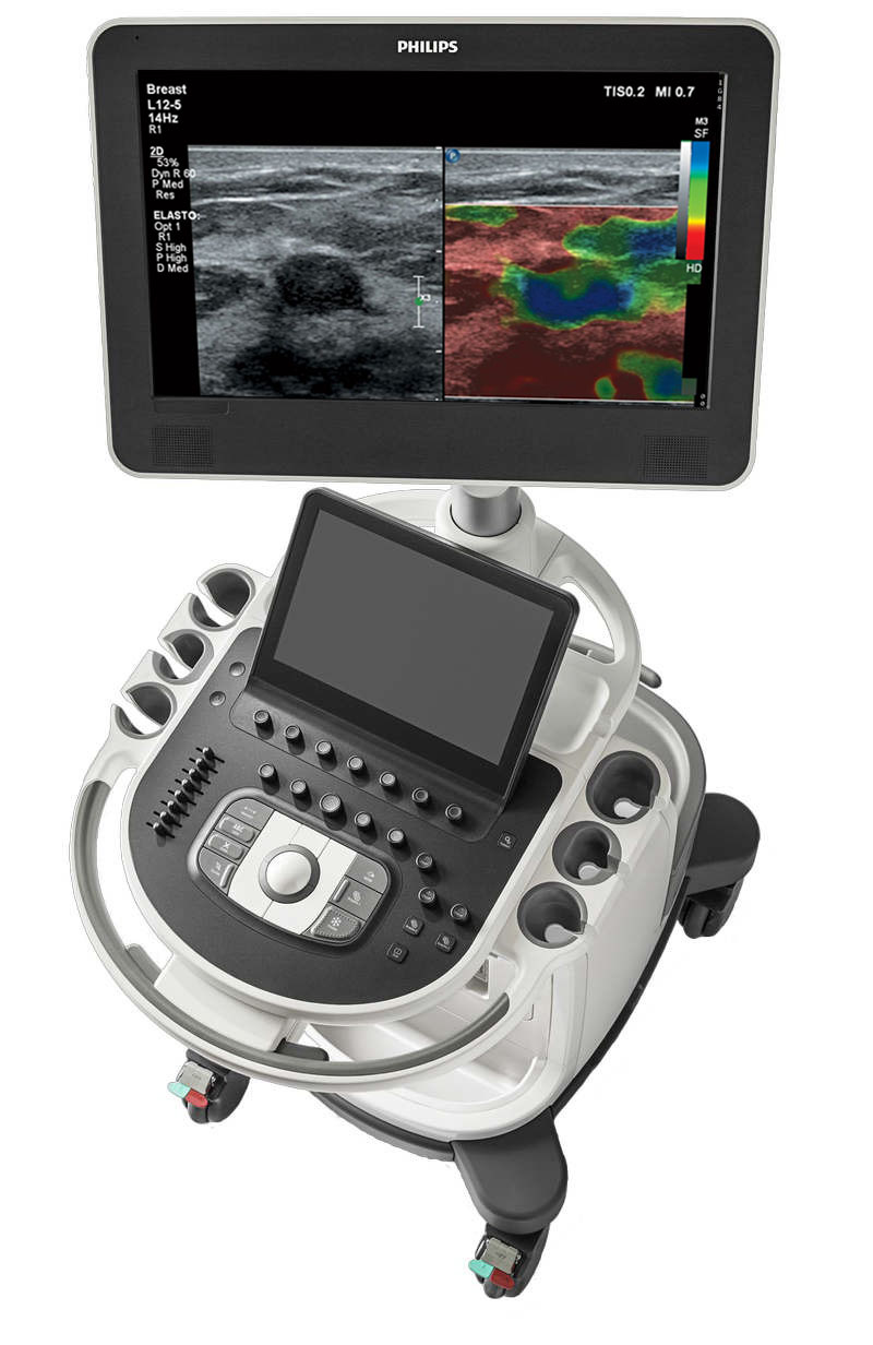 Эластография на Philips Affiniti 50