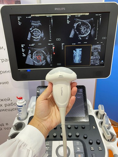 Монокристальный датчик V9-2 от Philips для 4D-визуализации