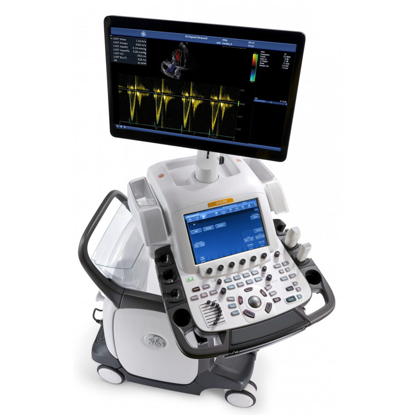 Режим допплера на GE Vivid E90