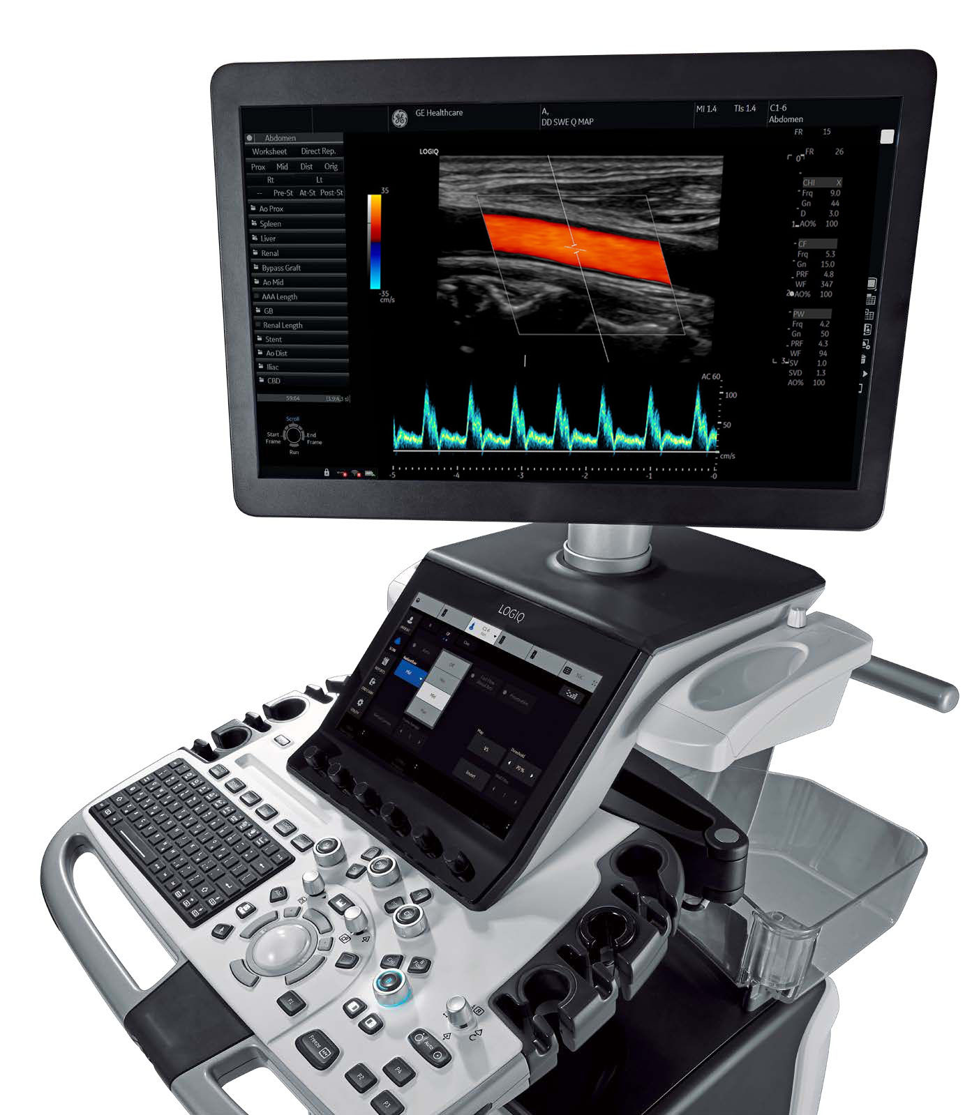 Режим допплера на УЗ-аппарате GE LOGIQ E10