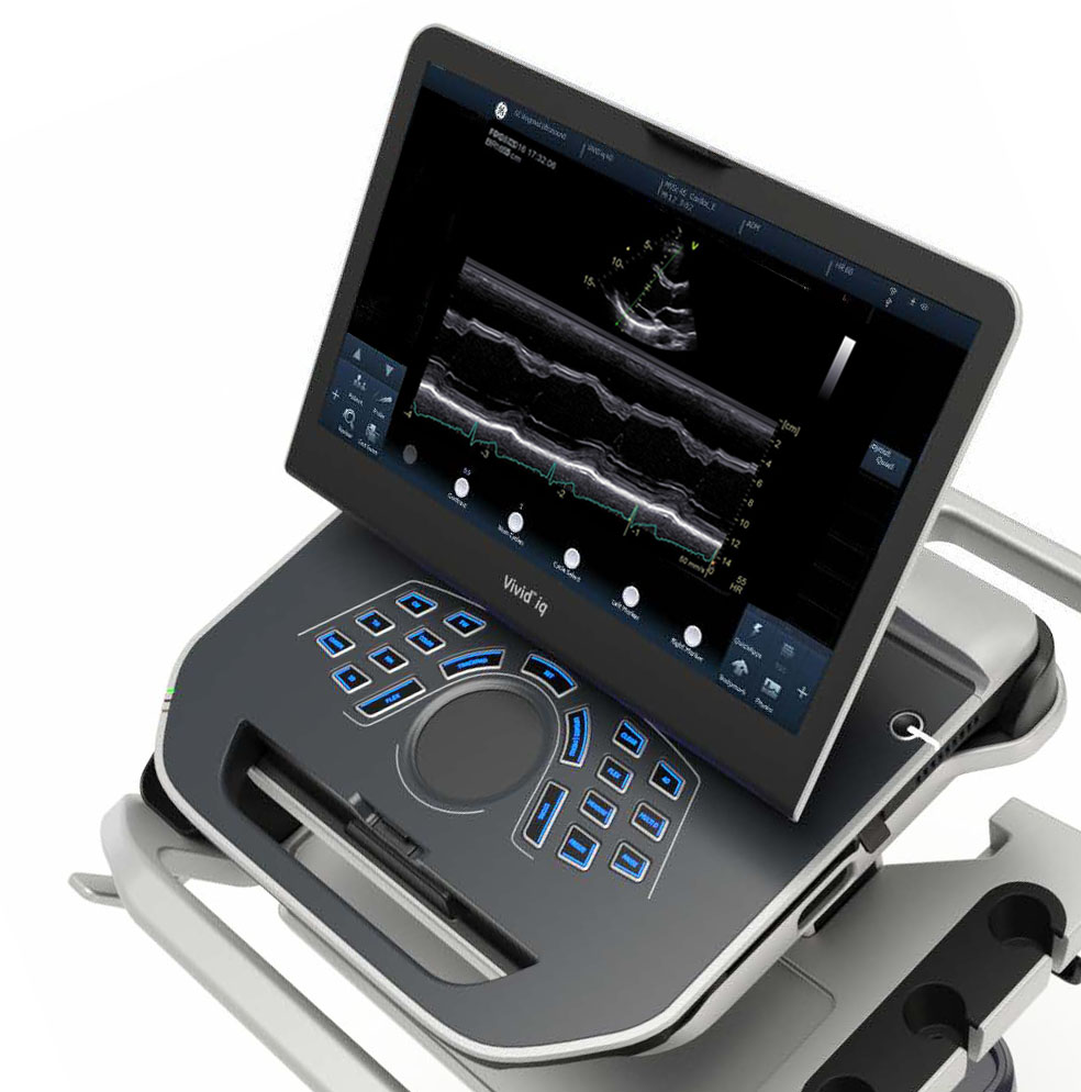 M-режим на аппарате УЗИ