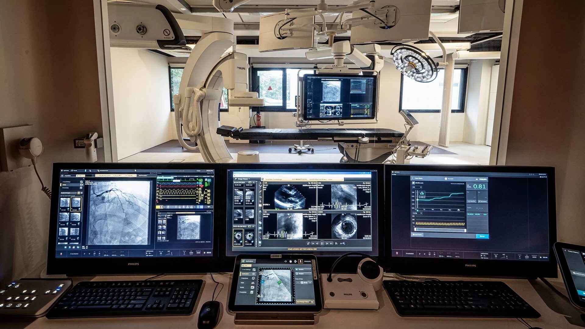 Данные, полученные на ангиографе, на мониторах