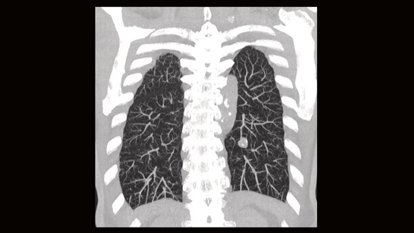 Изображение легких
