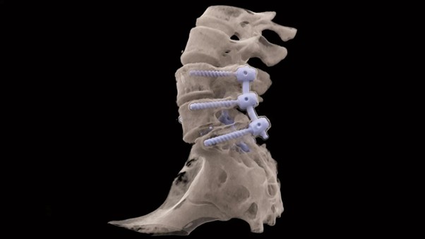 Снимок пояснично-крестцового отдела