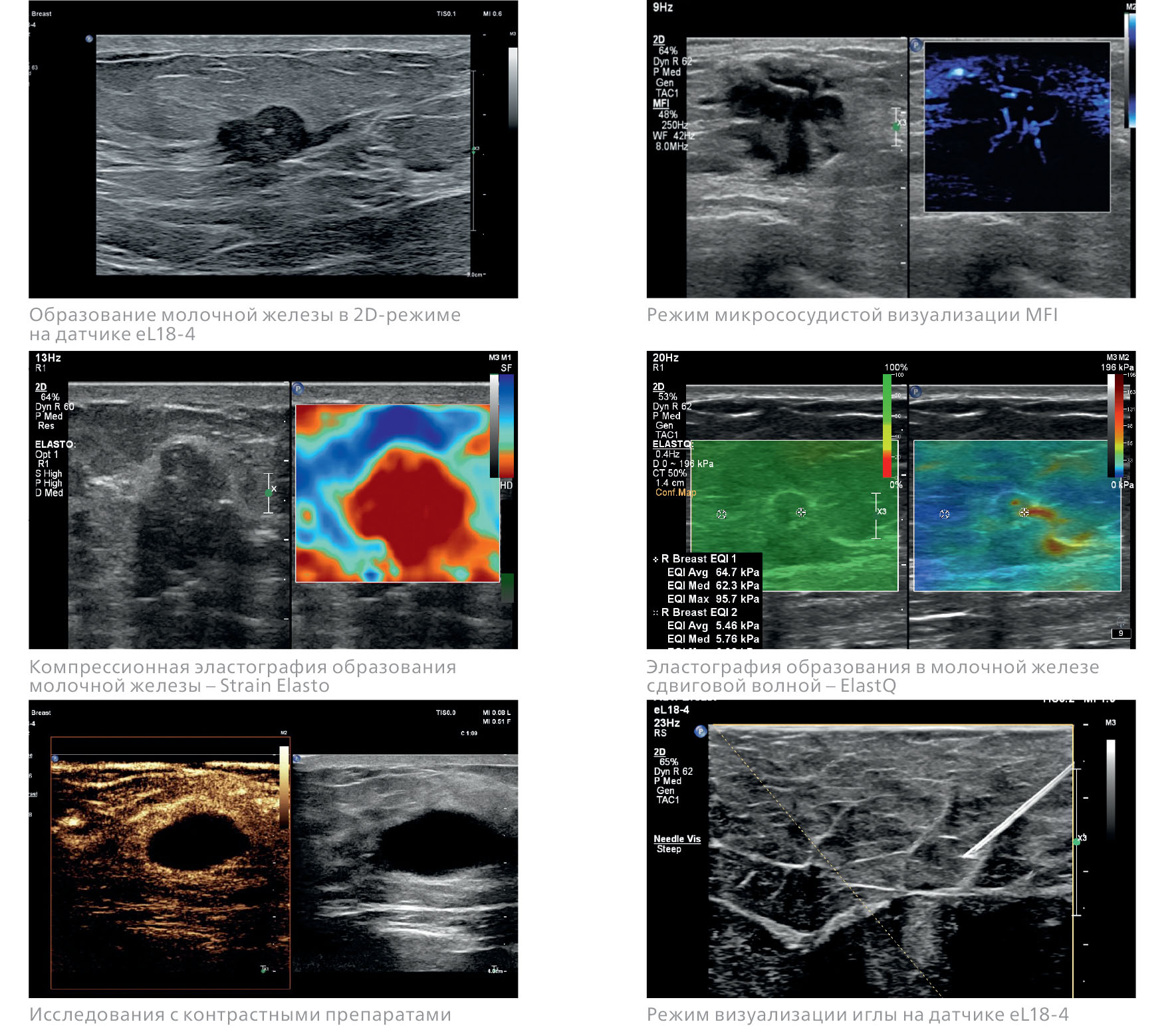 Снимки, выполненные во время УЗИ