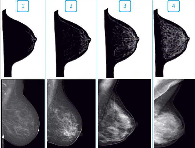 Типы строения молочных желез на снимках